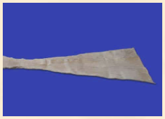 Achilles Tendon without Bone