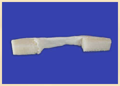 Hemi Patella Tendon