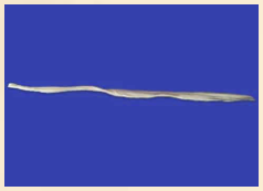 Peroneus Tendon