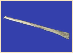 Posterior Tibialis Tendon