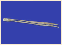 Semitendinosus / Gracilis Combo