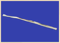 Semitendinosus Tendon